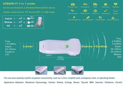 Sonda Wireless, Convex e Lineare - Foto 2